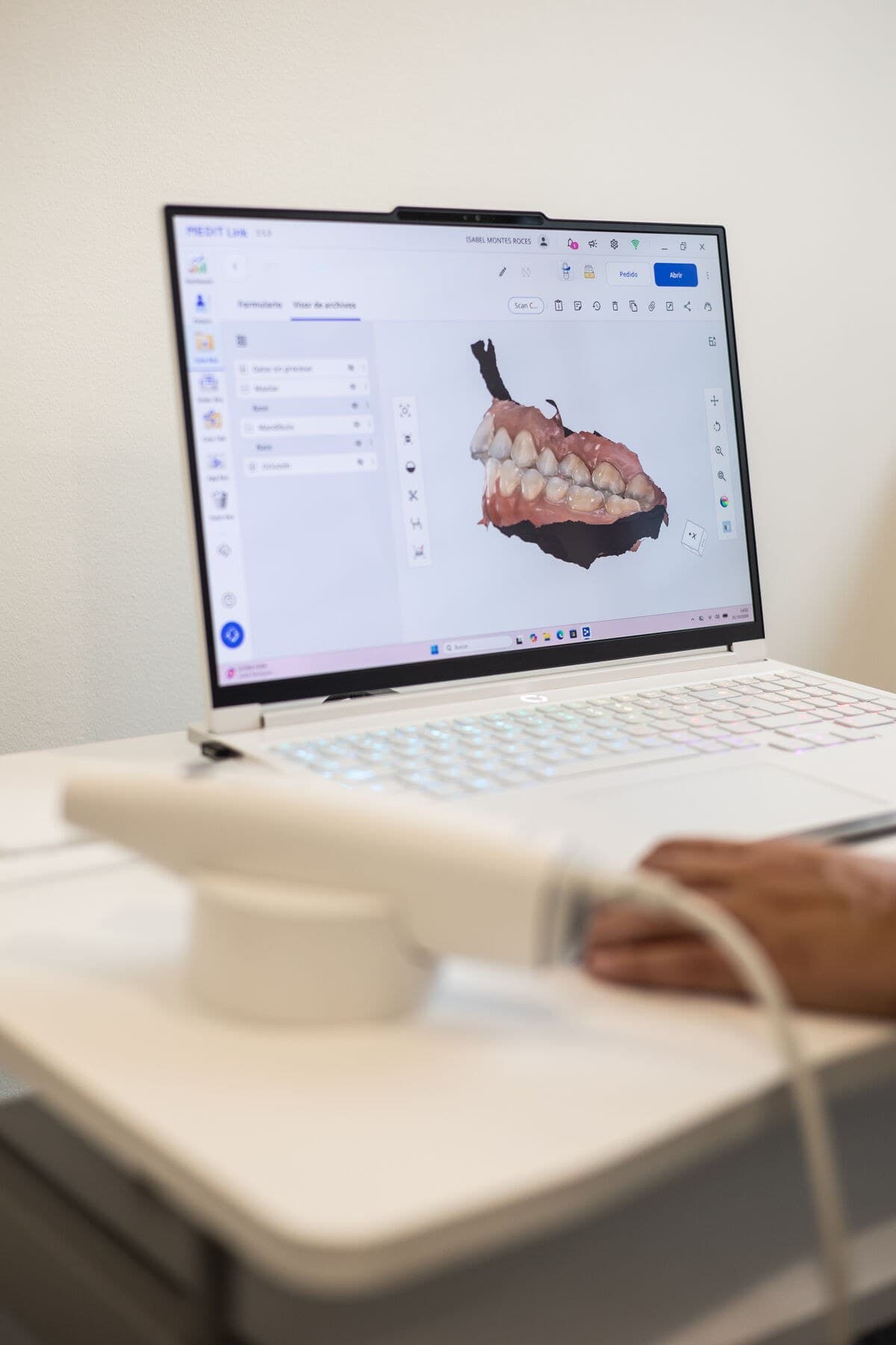 El escáner intraoral junto al portátil, con el modelo 3D de la boca en la pantalla