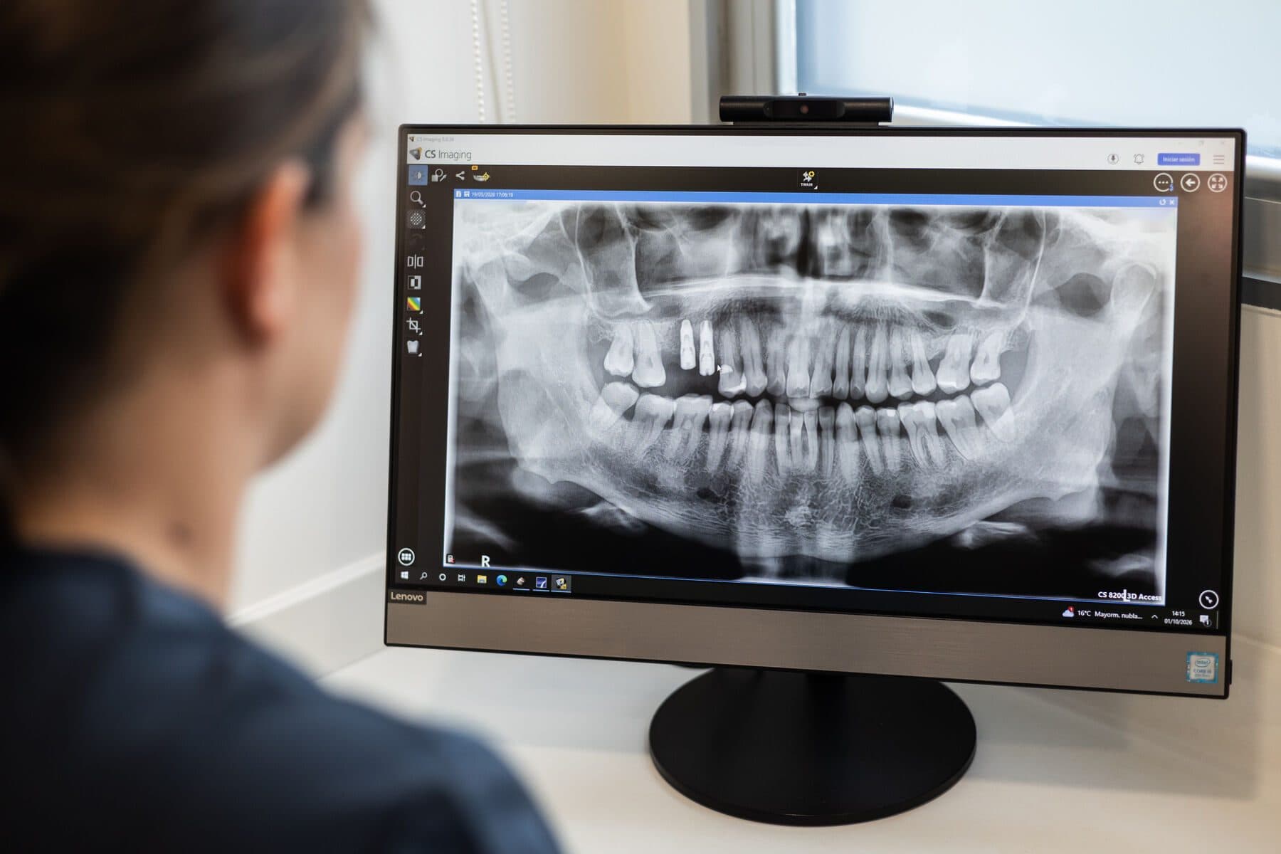 La radiografía panorámica en la pantalla, lista para explicarla